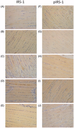 Figure 5. Immunohistochemical staining of skeletal tissues with IRS-1 and pIRS-1 in experimental rats (40× magnification). (A)–(E) represented the staining of IRS-1 in the NC, DBC, RSG, TCM and FME groups, respectively. (F)–(J) represented the staining of pIRS-1 in the NC, DBC, RSG, TCM and FME groups, respectively.