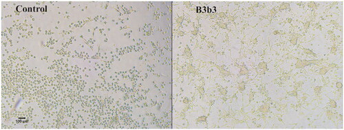 Figure 5. The effect of H. sitiens fraction B3b3 on DC morphology. DCs were matured and activated in the presence of fraction B3b3 at a concentration of 10 µg/mL or solvent control (control) for 2 h and viewed in light microscope. 10× magnification. Scale bar 100 µm.