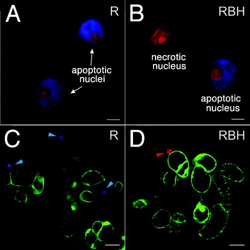 Figure 1. Laser confocal microscopy of R. cordifolia cells. Cells of the non-transformed R culture (A), (C) and rolB-transformed RBH culture (B), (D) were double-stained with propidium iodide and Hoechst 33342 as described in the Materials and Methods. (A), (B) Nuclei of R. cordifolia cells dyed to indicate necrosis (red) and apoptosis (blue + red) are presented. Propidium iodide was used to detect collapsed nuclei of necrotic cells. Hoechst 33342 was used to detect features of apoptotic cells, i.e., chromatin condensation at the periphery of nucleus and around nucleoli. (C), (D) A view of R. cordifolia cells triple-stained with fluorescein diacetate, propidium iodide and Hoechst 33342. Living cells were visualized with fluorescein diacetate (green cells). In a sample of control non-transformed cells (C), blue staining of the nuclei (cyan arrows) indicates an early phase of PCD and violet staining of the nucleus reflects a later phase of PCD. A necrotic cell with a red-stained nucleus is indicated by red arrow. Scale bars, 5 µm (A), (B) and 50 µm (C), (D).