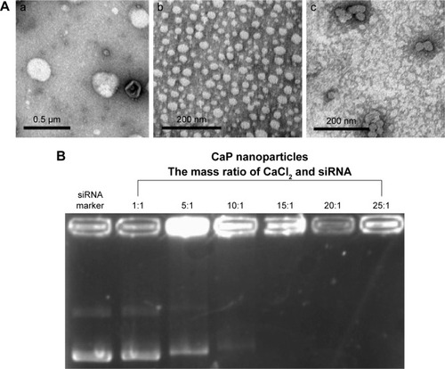 Figure 1 Images of transmission electron microscopy and gel retardation assays.Notes: (A) Transmission electron microscopy analysis of PCL (a), CaP nanoparticles (b), and PLCP (c). (B) Gel retardation assays of CaP nanoparticles with various mass ratios of CaCl2 and siRNA.Abbreviations: CaP, calcium phosphate; PCL, polycation liposome; PLCP, polycation liposome-encapsulated calcium phosphate nanoparticles; siRNA, small interfering RNA.