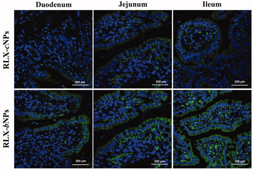 Figure 8. Ex vivo imaging on the intestinal retention of RLX-cNPs and RLX-bNPs. Excellent intestinal retention of RLX-bNPs supported by the striking fluorescence remained in the absorptive epithelium after transport for 2 h.