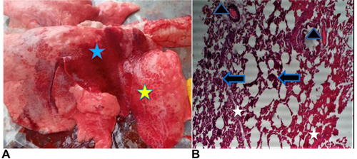 Figure 3 Macroscopic appearance of pulmonary congestion. Lung appeared notably red with diffuse (blue star) and variable ecchymotic hemorrhagic foci (yellow star) on the surface (A). Microscopic view (hematoxylin and eosin stains (H&E) ×10): Thick interalveolar septa packed with red blood cells (white star), presence of large number of red blood cells inside the vasculature (triangle), and hemosiderin-laden macrophages (wide arrow) (B).