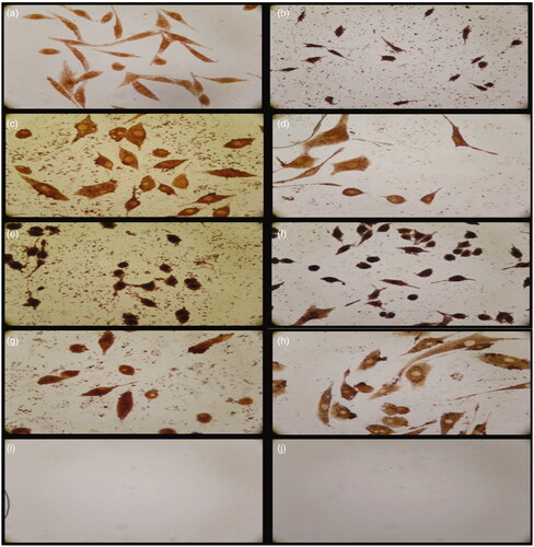 Figure 5. Immunohistochemical staining results of HS2 cell cultures. (a,b) Negative cell control (5 d, 10 d); (c,d) cream with 0.5% Spirulina platensis extract (5 d, 10 d); (e,f) cream with 1.125% S. platensis extract (5 d, 10 d); (g,h) cream control (5 d, 10 d) and (i,j) IHC control staining (5 d, 10 d).