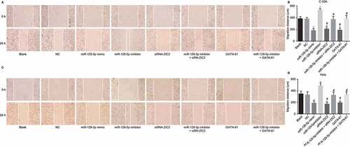 Figure 8. Scratch test shows that upregulation of miR-129-5p suppresses CC cell migration (× 100).Note: A, cell migration images of C-33A cell line after transfection; B, the histogram comparing migration distance in C-33A cell line after transfection; C. cell migration images of Hela cell line after transfection; D, the histogram comparing migration distance in Hela cell line after transfection; NC, negative control; miR-129-5p, microRNA-129-5p; ZIC2, zinc finger protein of the cerebellum 2; *, p < 0.05 compared with the blank and NC groups; #, p < 0.05 compared with the miR-129-5p inhibitor group.