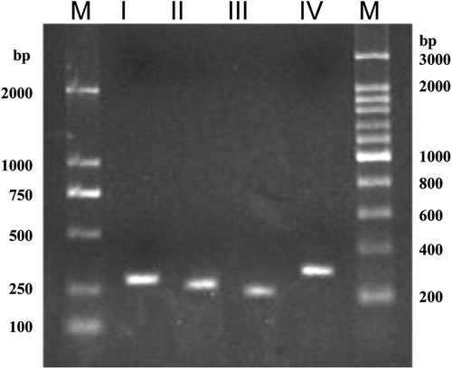 Figure 3. Specific amplification of rDNA ITS types I–IV from the genomic DNA of strain CBS 215. M, molecular size mark.