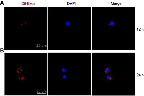Figure 2 DiI-labeled BMSC-Exos uptake. (A) Uptake of DiI-labeled BMSC-Exos by hepatic cells after 12 h. (B) Uptake of DiI-labeled BMSC-Exos by hepatic cells after 24 h. BMSC-Exos, Bone marrow mesenchymal stem cell-derived exosomes.