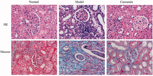 Figure 1. Effect of curcumin on histomorphological changes of renal tissues in DN-induced rats. Renal tissues were observed by staining with H&E and Masson and photographed by microscopy (bar: 400 µm).