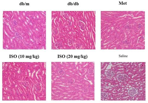 Figure 3 Effects of ISO on kidney pathology. Shown were H&E staining of the kidney tissues. Magnification: 20x.