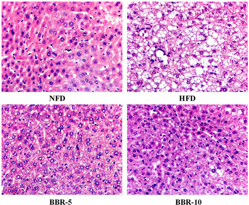 Figure 4 Effects of BBR on Hepatic pathological changes. Histological observation of the hematoxylineosin (H&E) sections (original magnification×400). Macrovesicular steatosis was observed in the livers of mice.