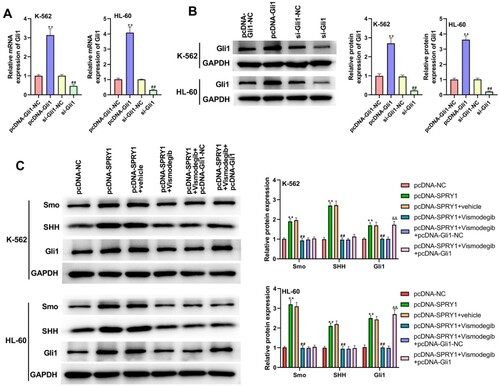 Figure 6. Vismodegib reversed the activation of Hedgehog signaling pathway by SPRY1 overexpression in K-562 and HL-60 cells. (a) After 48 h of transfection, the mRNA expression of Gli1 in K-562 and HL-60 cells was detected using qRT-PCR. (b) After 48 h of transfection, the protein expression of Gli1 in K-562 and HL-60 cells was measured using western blot. (c) After 48 h of transfection and Vismodegib treatment, the expressions of Smo, SHH and Gli1 in K-562 and HL-60 cells were measured by western blot. **P < .01, compared with pcDNA-Gli1-NC group; ##P < .01, compared with si-Gli-NC group (A and B). **P < .01, compared with pcDNA-NC group; ##P < .01, compared with pcDNA-SPRY1 + vehicle group; &&P < .01, compared with pcDNA-SPRY1 + Vismodegib + pcDNA-Gli1-NC group (C). The error bars represent the mean ± SD of three independent experiments.