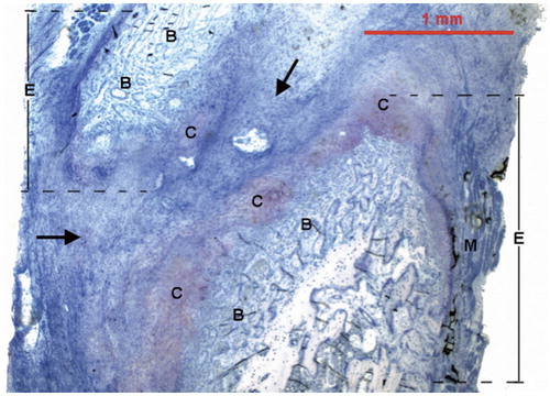 Figure 2. A low-power micrograph of a toluidine blue stained histological section of a rat rib fracture site after 7 days, showing a significant amount of soft-tissue collagenous matrix containing osteoprogenitor cells (arrows) linking together two ends (E) of fractured rib. Immunohistochemical analyses were performed in these fibrous tissue regions. Newly formed cartilage (C) and trabecular bone (B) within the callus are also evident. (M: skeletal muscle). Magnification: ×25.