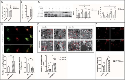 Figure 3. MiR-423-5p inhibits autophagosome maturation by suppressing autophagosome-lysosome fusion. (A) The expression ratio of mir-423-5p in the PBMCs of TB patients/healthy controls (HCs) from GSE29190 and GSE25435. (B) The levels of miR-423-5p in the cells transfected with miR-423-5p mimic or NC mimic. (C) The protein levels of P62 and LC3-II in the cells transfected with miR-423-5p mimic or NC mimic were tested by western blot. Target protein was normalized with β-actin. −/−: no starvation/no BA, +/−: 1 h starvation/no BA, +/+: 1 h starvation/50nM BA, −/+: no starvation/50nM BA. The experiments repeated more than three times. (D) The number of LC3-GFP dots and the co-localization of LC3-GFP puncta with lysosomes (lysotracker red DND) in the macrophages treated with miR-423-5p mimic or NC mimic were analyzed. More than 20 macrophages from three independent experiments were analyzed. Scale bars: 5μm. (E) Autophagosomes in the macrophages treated with miR-423-5p mimic or NC mimic were observed by electron microscopy. Autophagosomes are indicated by arrows. The number of autophagosomes from an accumulated area of >200 μm2 (>20 cells) was statistically analyzed. Scale bars: 1μm. (F) The lysosomal proteolytic activity of the macrophages treated with miR-423-5p mimic or NC mimic was analyzed by DQ-BSA. The fluorescent intensity from at least 40 cells was quantified. Scale bars: 10 μm. All statistical data, except (A) are presented as mean ± SD, and error bars indicate the SD. NC: negative control. *P < 0.05, ** P < 0.01, *** P < 0.001.