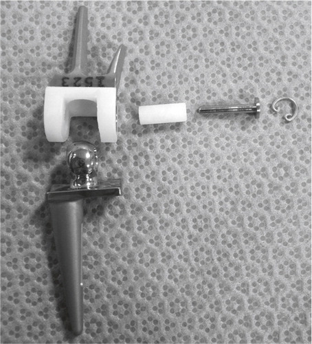 Figure 11. The Trispherical wrist arthroplasty. (Courtesy of Dr Figgie.)