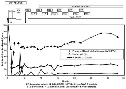 Figure 2 Clinical course and remission in the patient with Ph+ALL treated with bortezomib. The graph shows persistence of BCR-ABL-positive disease despite correction of white counts in the initial phase of the disease, when the patient was treated with leukopheresis, followed by induction chemotherapy and TKI (Imatinib). Bortezomib was added at approximately 6 months following diagnosis. Bortezomib and rituxan are maintained at alternate months, while dasatinib is given orally every day. Her BCR-ABL expression levels, by molecular analysis (RT-PCR for p210 transcripts), turned negative following this combination regimen. The data is truncated at 35 months. The patient maintains a similar status at 48 months at last follow-up.