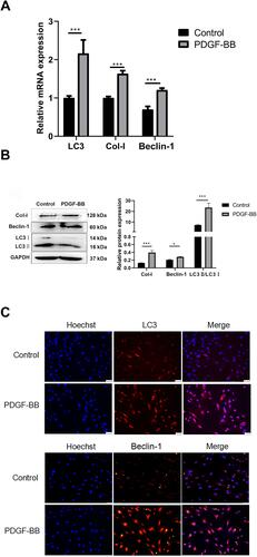 Figure 5 PDGF-BB promoted the fibrosis and activated the autophagy of the oral mucosal FBs. (A) Detection of the expression of Col-I, Beclin-1, and LC3 at the mRNA level by RT-qPCR. Compared with the control group, the PDGF-BB group’s data are represented as the means ± SD of at least three independent experiments. P < 0.05; (***P < 0.01). (B) Western blot detection of autophagy and fibrosis in primary oral mucosal FBs. The expression of fibrosis-related protein Col-I and autophagy-related proteins Beclin-1 and LC3 in primary oral mucosal FBs were detected after PDGF-BB stimulation for 24 h. PDGF-BB group vs control group, P < 0.05. (*P < 0.05, ***P < 0.01). (C) Indirect immunofluorescence detection of cell autophagy (×200). Indirect immunofluorescence was used to detect the expression and localization of autophagy-related proteins LC3 and Beclin-1 in primary oral mucosal FBs after PDGF-BB stimulation for 24 h. Hoechst 33342 was used to stain the nucleus; rabbit anti-LC3 and rabbit anti-Beclin-1 were the primary antibodies, and Cy3-goat anti-rabbit IgG was the secondary antibodies. LC3 and Beclin-1 showed red fluorescence.