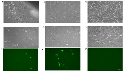 Figure 1. (A) Buffalo fibroblast cells outgrowth from a tissue explant in a T-25 culture flask. (B) Cells in a T-25 flask before electroporation experiments. (C) Cells immediately after electroporation. Fluorescence microscopic images showing transfection with best electroporation parameters in 2 mm cuvette (D’) with its corresponding bright field image (D), in 4 mm cuvette (E’) with its corresponding bright field image (E), and in electroporated control without plasmid (F’) with its corresponding bright field (F). Scale bar = 100 µm.