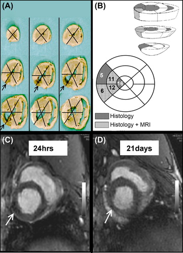 Figure 3. Cell detection using histology and MRI. (A) The left ventricle was divided into 16 segments based on the vascular territories in order to detect the injected BMMNC. The infarction area is designated by arrows. (B) BMMNCs were detected from the same segment area using MRI or histology (C–D) Hypointense area in MRI is interpreted as BMMNCs (arrows). The left ventricle has become thinner after 21 days due to AMI.