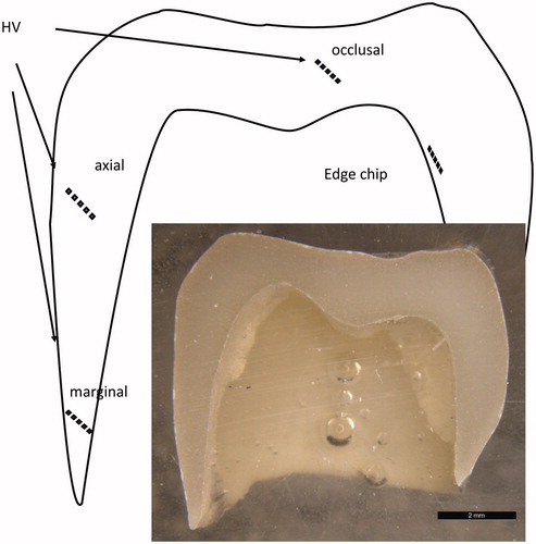 Figure 2. Premolar monolithic crowns embedded in epoxy and cut in half were used for the study. Three regions (marginal, axial and occlusal) were analyzed in each crown.