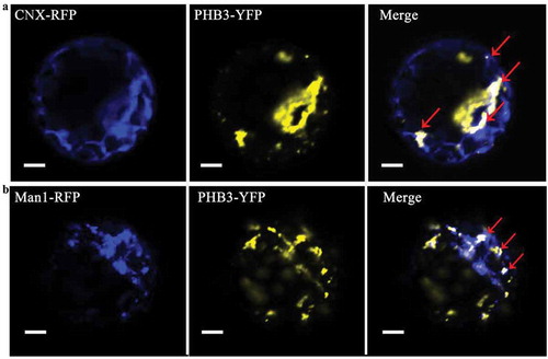 Figure 1. The Golgi and endoplasmic reticulum localization of PHB3. A, PHB3-YFP and endoplasmic reticulum marker CNX-RFP are expressed in the indicated protoplasts. The CNX-RFP signal (blue), PHB3-YFP signal (yellow), and merged photos are shown from representative samples. The red arrows indicate the co-localization in endoplasmic reticulum. Scale bar = 20 μm. B, PHB3-YFP and Golgi marker Man1-RFP are expressed in the indicated protoplasts. The Man1-RFP signal (blue), PHB3-YFP signal (yellow), and merged photos are shown from representative samples. The red arrows indicate the co-localization in Golgi. Scale bar = 20 μm.