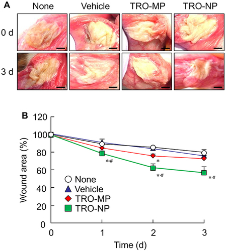 Figure 7 Changes in the wound area in the cheek pouches of hamsters with OM 0–3 days after treatment with TRO gels. (A) Representative images and (B) wound area of cheek pouches treated with TRO gels. Bar in the image (A) indicate 1 mm. Total n=23 [none, n=8; vehicle (n=5), TRO-MP (n=5), and TRO-NP gels (n=5)]. *P<0.05 vs vehicle for each category (Tukey–Kramer test). #P<0.05 vs TRO-MP gel for each category (Tukey–Kramer test). The therapeutic effect of the TRO-NP gel was higher than that of the TRO-MP gel in the cheek pouches of hamsters with OM.
