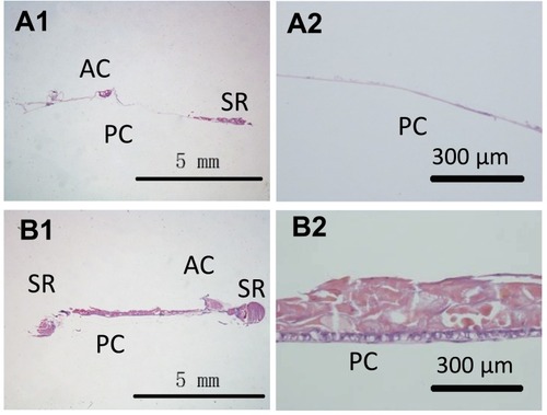 Figure 11 Photographs of histological sections cut from lens capsular bag with drug-eluting IOL (A1) and pristine IOL (B1) implantation. A2 and B2 images are the amplification of the A1 and B2 of the posterior capsule.Abbreviations: SR, Soemmering’s ring; AC, anterior capsule; PC, posterior capsule.