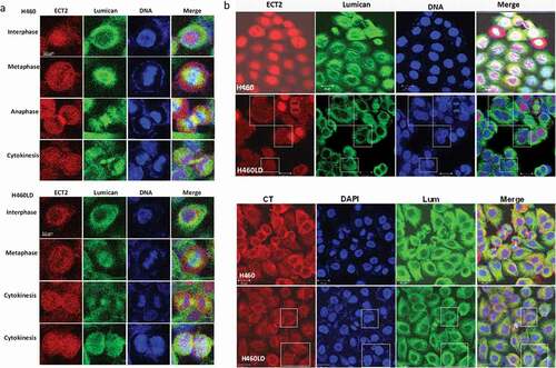 Figure 6. Downregulation of lumican decreases ECT2 expression and disrupts the processes of cytokinesis.