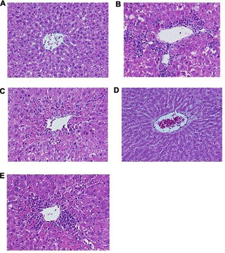 Figure 3 Light micrographs showing the effect of compound 2 on CCl4-induced hepatotoxicity in rats. (A) Normal hepatocytes. (B) CCl4-induced severe necrosis and inflammation. (C) Pretreatment of rats with compound 2 (10 mg/kg). (D) Pretreatment of rats with compound 2 (20 mg/kg). (E) Pretreatment of rats with silymarin (10 mg/kg). Magnification × 40.