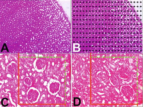 Figure 1. (A) A light microscopic image from a selected liver section. (B) Light microscopic image at (A) after superimposing a point-counting grid on it. (C and D) Stereological procedures for sampling and applying the physical dissector. C reference and D are look-up sections.*Section profiles of glomeruli in the reference and look-up sections. The black arrow was counted as a dissector particle if its profile was not seen in the look-up section. The arrow with a white filling sign profile of the particle in the look-up section was not seen in the reference section.