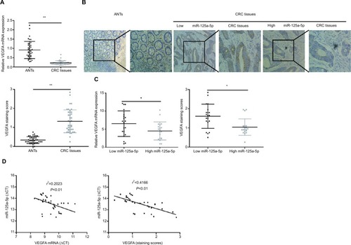 Figure 4 The expression of miR-125a-5p was negative compared with that of VEGFA in CRC tissues. (A) The expression of VEGFA mRNA in CRC tissues was markedly higher than that in ANTs. (B) IHC score of CRC tissues was higher than that in matched ANTs. (C) The statistical graph showed that IHC scores of VEGFA or VEGFA mRNA expression levels in high miR-125a-5p CRC tissues were significantly lower than those of low miR-125a-5p CRC tissues. (D) The correlation analyses were performed between VEGFA mRNA expression levels or IHC scores of VEGFA and the levels of miR-125a-5p expression in CRC tissues. Data are shown as mean±SD.*P<0.05, **P<0.01.Abbreviations: CRC, colorectal cancer; ANT, adjacent normal tissue; IHC, immunohistochemistry.