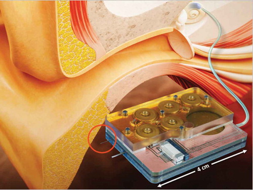 Figure 2. Schematic of the delivery chip component of an intracochlear drug delivery (ICDD) device comprising microfluidic drug storage and flow control. The ICDD device is connected, via a small tube inserted into the scala tympani, to the basal turn of the human cochlea to show potential clinical implementation.