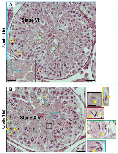 Figure 3. A, B. Sloughing of elongating/elongated spermatids from the seminiferous epithelium of rat testes by 8 hr after a single dose of adjudin (50 mg/kg b.w., by oral gavage). A stage VI (A) and a stage XIV (B) tubule are shown by H&E (hematoxylin and eosin) staining of paraffin-embedded testis sections. It is noted that elongating spermatids (step 18 spermatids in (A) and step 14 spermatids in (B)) are detected in the tubule lumen. These 2 micrographs illustrate as if the tubular lumen has closed, which may possibly be due to a shutdown of fluid secretion by Sertoli cells rather than physical shedding of spermatids, because the spermatid heads still look to be well embedded between the round spermatids, such as in (A) except for a few step 18 spermatids that are obviously found in the lumen, away from round spermatids as annotated by blue arrowheads. Also, there appears to be a layer of apoptotic pachytene spermatocytes around the basal layer of the tubule (annotated by red arrowheads). However, it is still likely that there is a disruption of spermatid adhesion to the Sertoli cell, at least an onset of apical ES disruption by 8 hr after adjudin treatment, so that spermatids are depleted at later time points. This possibility is supported by studies that have illustrated a disruption on the spatiotemporal expression of actin regulatory proteins Arp3, Eps8, and palladin in ∼5- to 24-hr following adjudin treatment,Citation68-70 which subsequently perturbs F-actin organization, leading to eventual apical ES breakdown. In (B), this is a stage XIV tubule because meiosis is detected (meiotic germ cells are annotated by green arrowheads). Also, many spermatids have lost their polarity, recognized by heads, which are no longer pointing toward the basement membrane (annotated by yellow arrowheads in color-boxed areas which are the corresponding magnified images shown on the left panel). Scale bars: (A), 40 μm, and 150 μm in inset; (B), 40 μm, and 20 μm in inset, which applies to other insets in this panel.