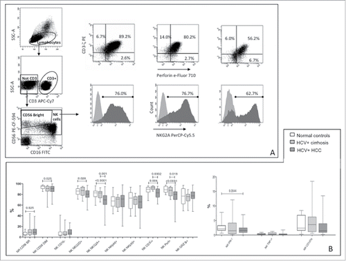 Figure 1. Phenotype and function of NK-cells in patients and controls. (A) Dot plots showing gating strategy and phenotype for CD3ζ, perforin and NKG2A in a representative healthy subject, a patient with HCV-related liver cirrhosis and a patient with HCC (left to right). (B) Differential distribution of NK-cell phenotypes and functional parameters in HCC patients and controls. CD107a expression was evaluated on unstimulated NK-cells. Significance levels are shown on top of each panel.