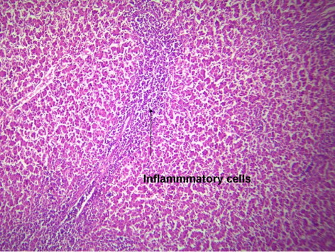 Figure 6. Liver of −HSCAS −AF group of 42-day-old broiler chickens showing mild inflammatory cell infiltration of the portal area (H&E × 160).