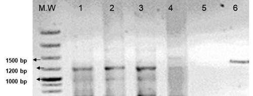 Figure 1 PCR amplification of 1200bp amplicons of domain V of the 23S rRNA gene of H. pylori using Versalovic et alCitation8 primer pair. M.W, 1kb molecular weight marker; Lane 1 to 3, 1200bp amplified fragments; Lane 4, H. pylori-negative biopsy DNA; Lane 5, Negative Control (No DNA only PCR reaction mix); Lane 6, Standard 1400 bp amplicon obtained from the same primer set using different H. pylori-positive biopsy DNA.