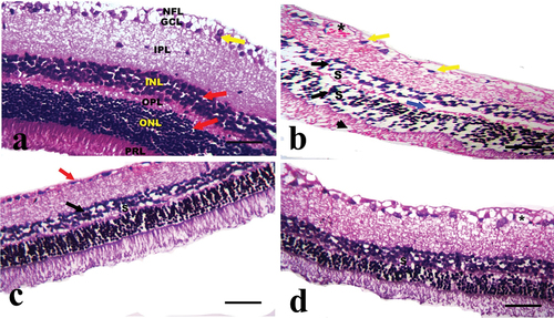 Figure 2. A photomicrograph of the cross section of the rat retina in the experimental groups (hematoxylin and eosin stain). A: CONT group showing normal histological structure of well-organized retinal layers arranged from outward to inward as photoreceptor layer (PRL), outer nuclear layer (ONL) of nuclear cells (red arrow), outer plexiform layer (OPL), inner nuclear layer (INL) of nuclear cell (red arrow), inner plexiform layer (IPL), ganglion cell layer (GCL) of ganglion cells with large vesicular nuclei (yellow arrow), and nerve fiber layer (NFL). B: STZ group showing slight disorganization of retinal layers, loss of some photoreceptor processes (arrow head), focal widening of intercellular spaces (S) between small dark-stained nuclear cells (black arrows) in ONL and INL appearing as empty spaces between the nuclei, focal areas of disruption of OPL can be observed (blue arrow), pyknotic nuclei of ganglion cells (yellow arrow), and dilated congested blood capillary with vascular leakage (star) in GCL are observed. C: the STZ+MTF group exhibits slightly improved retinal pathology. Small empty spaces (S) between the nuclei of the INL with some shrunken pyknotic nucleui (black arrow), the thinning of the OPL, and some shrunken pyknotic nuclei of the ganglion cell in the GCL (red arrow) are present. D: STZ+ MTF-NE group showing marked improvement of the retinal pathology. Small empty spaces (S) between the nuclei of the INL and some dilated blood capillaries (stars) in the GCL are observed (scale bar = 50µm).