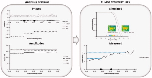 Figure 5. Example showing phase steering for patient 2 (cervix) with recorded phases and amplitudes per antenna, the average measured temperature during the steady state period and the simulated temperature distribution in the tumour with the simulated temperature volume histogram before and after adaptation of the phases based on treatment planning. Symbols • indicate the times at which phase steering was performed to improve tumour temperatures.