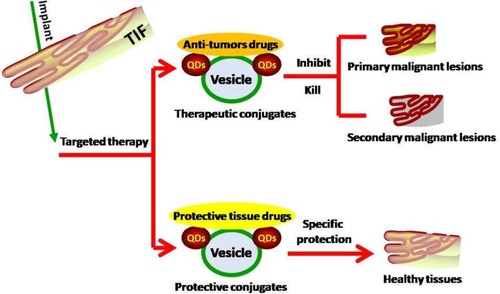 Figure 3 NV implantation in the TIF to target GI premalignant lesions. NVs carrying either an anti-tumor drug to suppress or kill the primary lesions or secondary malignant lesions, or protective conjugates to shield healthy tissues or cells from the effects of the tumor, thereby avoiding secondary malignant transformation, can be implanted into the TIF.