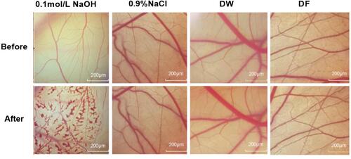 Figure 9 Safety determination of DW and DF.