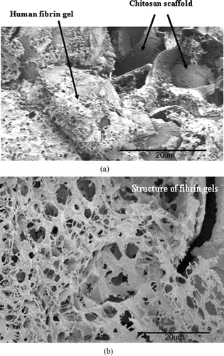 FIG. 2 (a) SEM micrograph of dense human fibrin gels that contain poly dispersed pores and adhere to chitosan scaffolds in an LCSHFG system (× 500). The square area of the gels is further observed as presented in Figure 2b. 76 × 57 mm (600 × 600 DPI). (b) SEM micrograph of fibrin structures in LCSHFG system comprised of several layers of the fibrin network with polydispersed pores (× 2000). 76 × 57 mm (600 × 600 DPI).