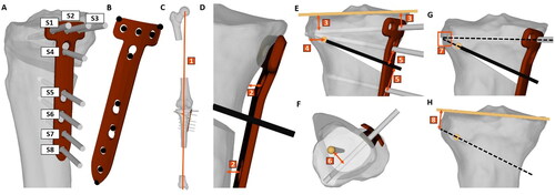 Figure 4. Constraints. Non-linear constraints of the optimization algorithm. (A) Screw numbering (B) Eleven checkpoints on the fixation plate were defined. Besides, various constraints were formulated to ensure (C) the preservation of leg length, (D) ideal contact between bone and plate and (E,H) proper placement of osteotomy axis, cutting plane and screws with respect to each other and the bone.