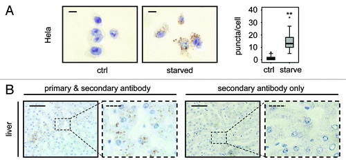 Figure 5. LC3 staining allows quantification of endogenous LC3 puncta in human cells and detects LC3 positive puncta in human tissue. (A) Representative immunohistochemical staining for LC3 in HeLa cells that were grown in replete medium or starved for 2 h in EBSS. Images were taken at 100x magnification and the scale bars represent 20 µm. Box plots are used to display the quantification of LC3-puncta/cell for each condition. “**” indicates statistical significance (p < 0.01, Mann-Whitney). LC3-positive puncta of 50 cells from each group were counted. (B) Human liver stained with LC3 antibody (left two panels) and without primary antibody as control (right two panels). Panels with straight borders are complete, i.e., not cropped and representative overview images taken at 40x magnification with a scale bar (straight) that represents 100 µm. Panels with dashed borders are zoomed and cropped sections from the overview panels (cropped regions are indicated by the small dashed rectangle in the overview panels). The dashed scale bars in the cropped panels represent 20 µm. Antigen retrieval for LC3 was undertaken in Tris-EDTA, pH 9.