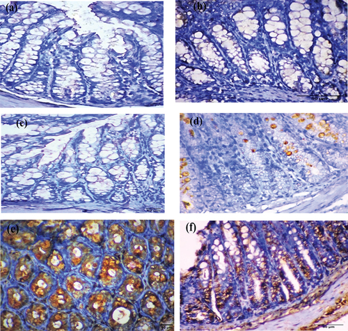 Figure 5. Photomicrograph of the colorectal section after four weeks through the mucosa layer showing (a) control and (b) EDTA groups with negative staining, (c) DMSO, and (d) Nic groups with cytoplasmic immunostaining reactions, (e) DMH group with strong immunostaining reaction, and (f) Nic-DMH group with moderate reaction. (AIF IHC staining; scale bar = 50 µm).