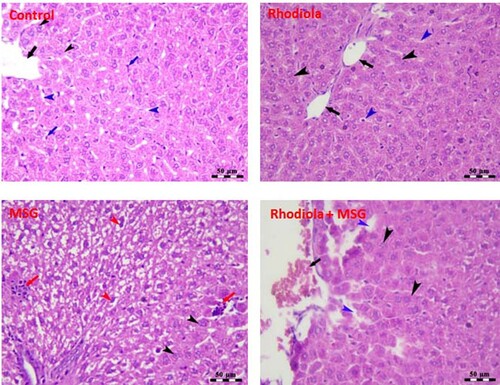 Figure 4. Liver histopathology after MSG and R. rosea administration in rats. Upper left photo is the central lobe of the liver of the control group, showing polyhedral-shaped hepatocytes that are arranged in a cord-like pattern and are separated by blood sinusoids (blue arrowheads) that radiate from the intact central vein (black arrows), and the presence of Kupffer cells (blue arrows). Upper right photo is the central lobular area of the liver of R. rosea-treated rats, showing an intact central vein (black arrows), intact cords for hepatocytes (black arrowheads), and distinct blood sinusoids (blue arrowheads). Down left photo is the liver of the MSG-treated group, showing intact hepatocytes in the centrilobular area (black arrowheads) and vacuolar degeneration of hepatocytes at the periphery of hepatic lobules (red arrowheads) in addition to mononuclear cell infiltration (red arrows). Down right photo is the liver of the R. rosea plus MSG-treated group, showing moderate congestion of the liver central vein (black arrow), intact hepatocytes (black arrowheads), and mildly dilated blood sinusoids (blue arrows). Scale bar = 50 µm for all fields.