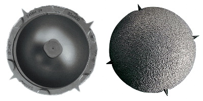 Figure 17.  Bi-Metric® solid cup with Ti plasma-spray porous coating and Ringloc® locking mechanism (Biomet Inc).