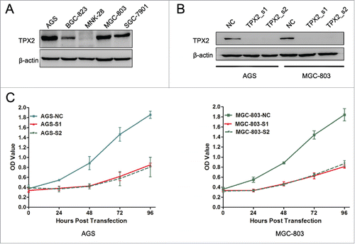 Figure 2. Effects of reduced TPX2 expression on the inhibition of gastric cancer cell viability. (A) Western blot analysis of TPX2 protein in gastric cancer cell lines. (B) Western blot. Two different siRNA constructs were transiently transfected into gastric cancer cells to knock down TPX2 expression. (C) CCK-8 assay. Two TPX2 siRNAs were transiently transfected into gastric cancer cells and then subjected to the CCK-8 cell viability assay.