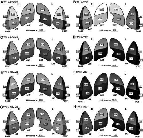 Figure 3 Visual model of LUS results.