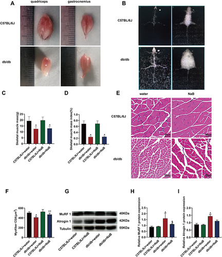 Figure 3 NaB ameliorated gastrocnemius myofiber atrophy of db/db mice without affecting muscle mass. (A) Appearance of exemplary quadriceps and gastrocnemius from the 15-week-old C57BL/6J and db/db mice. (B) The dual energy X-ray absorptiometry (DXA) image of C57BL/6J and db/db mice at 15-week. (C) Statistical analysis of muscle mass measured by the dual energy X-ray absorptiometry (DXA) in 4 groups of mice. (D) Statistical analysis of muscle mass index measured by DXA in 4 groups of mice. (E) Gastrocnemius myofibers from the 4 groups with HE staining. (F) Statistical analysis of cross-sectional area (CSA) of myofiber. (G) Protein expression of MuRF 1 and Atrogin 1 in the gastrocnemius of mice in the 4 groups. (H) and (I) MuRF 1, Atrogin 1 and tubulin were detected. The histogram showed the grayscale value ratio. Data are expressed as mean ± SEM (n = 6 in each group). *P < 0.05 vs C57BL/6J+water group; **P < 0.01 vs db/db+water group; $P < 0.05 vs db/db+water group. The bar represents 50 μm.