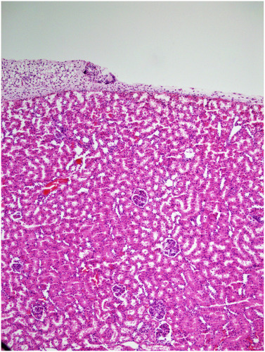 Figure 4 Congested vascular structures were observed focal in the saline group (H&E×100).
