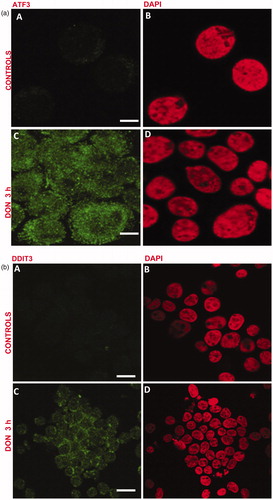 Figure 1. DON induces ER stress. (a) Exposure of Jurkat cells for 3 h to 0.5 µM DON increases ATF3 expression. (A, B) untreated; (C, D) treated. (A, C) ATF3 staining; (B, D) DNA staining with DAPI. Scale bars: 8 (treated) and 6 μm (untreated). (b) Exposure of Jurkat cells for 3 h to 0.5 µM DON increases the expression of DDIT3. (A, B) untreated; (C, D) treated. (A, C) DDIT3 staining; (B, D) DNA staining with DAPI. Scale bars: 21 (treated) and 18 μm (untreated).