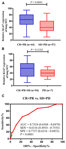 Figure 3 High Ki-67 expression can be considered a biomarker for the objective efficacy of chemotherapy in advanced lung squamous cell carcinoma (SCC). (A) Comparison between Ki-67 expression in the CR+PR group and SD+PD group. (B) Comparison between Ki-67 expression in the CR+PR+SD group and PD group. (C) The expression levels of Ki-67 could distinguish patients with high objective efficacy from patients with low objective efficacy in advanced lung SCC according to the ROC analysis.